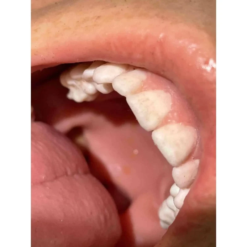 Close-up of the open mouth of a Ruth Lee™ Advanced Water Rescue Manikin, designed for realistic airway and rescue procedure training.